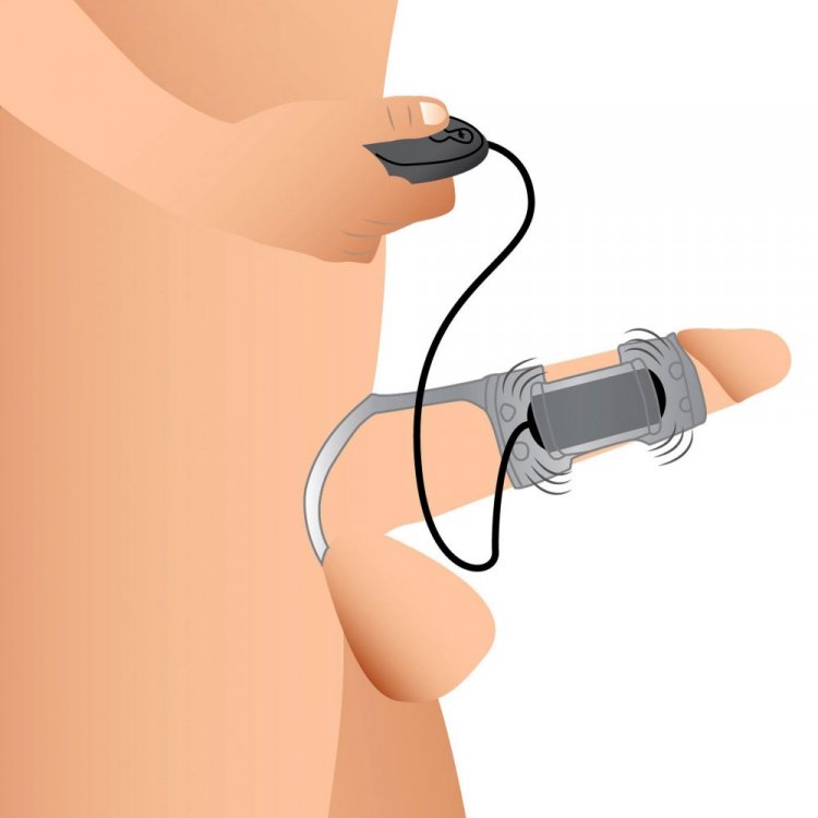 Trinity Men 20X Dual Cock Teaser w/ Cock & Ball Ring